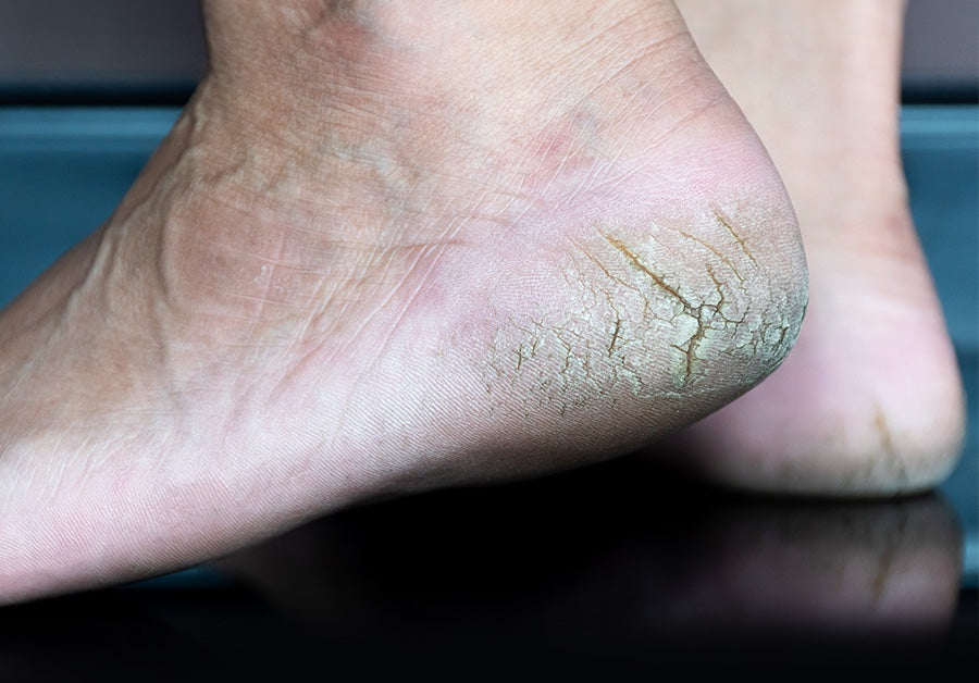 Forbes Health Group. What you need to know before choosing FHG as your Podiatry provider.